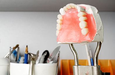 Protésico Dental Francisco Javier Socarrás modelos de prótesis dental