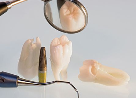Protésico Dental Francisco Javier Socarrás elaboración de prótesis dentales 3